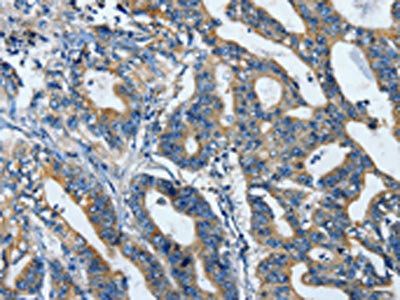 TLR4 Antibody