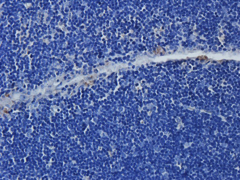 TLR4 Rabbit Polyclonal Antibody