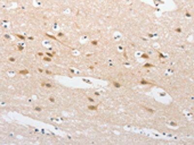 TLR5 Antibody