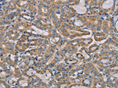 TLR6 Antibody