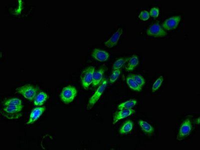 TM4SF1 Antibody