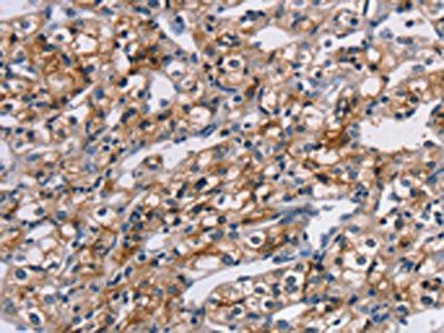 TM4SF1 Antibody