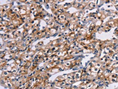 TM4SF1 antibody