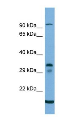 TM6SF2 antibody