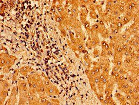 TM6SF2 Antibody