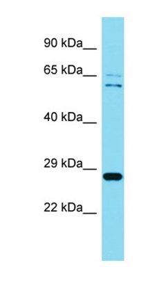 Tma16 antibody