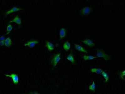 TMBIM1 Antibody