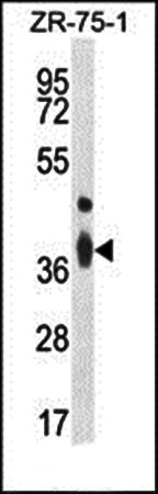TMBIM4 antibody