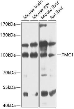 TMC1 antibody