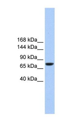 TMC2 antibody