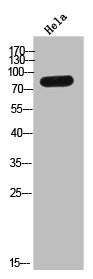 TMC8 antibody