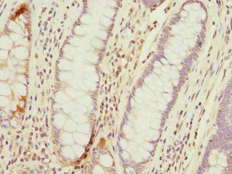 TMED10 Antibody