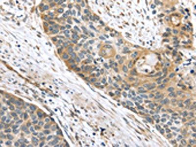 TMED2 Antibody