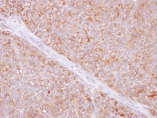 TMED9 Rabbit Polyclonal Antibody