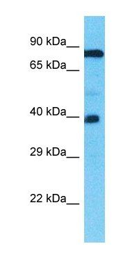 TMEFF1 antibody