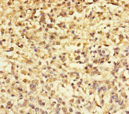 TMEFF2 Antibody