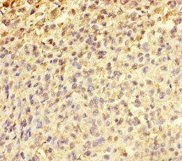 TMEFF2 Antibody