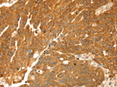 TMEFF2 Antibody