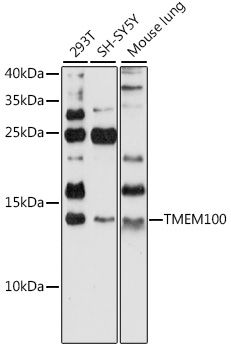 TMEM100 antibody