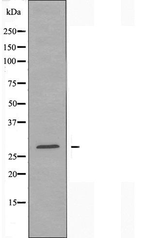 TMEM101 antibody