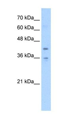 TMEM104 antibody