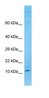 TMEM105 antibody