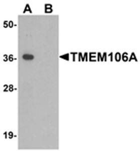 TMEM106A Antibody