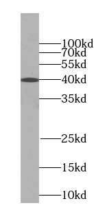 TMEM106B antibody