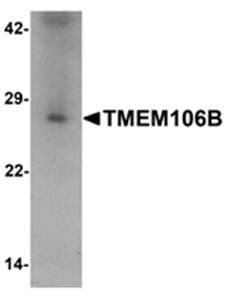 TMEM106B Antibody