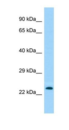 TMEM114 antibody