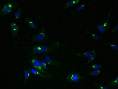 TMEM115 Antibody