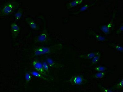 TMEM115 antibody