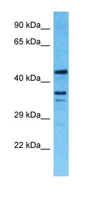 TMEM116 antibody