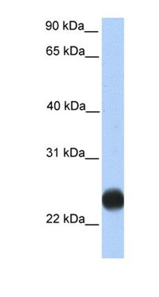 TMEM123 antibody