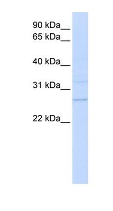 TMEM126B antibody