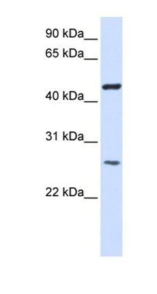 TMEM127 antibody