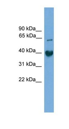 Tmem130 antibody