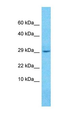 TMEM136 antibody