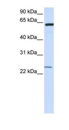 TMEM138 antibody
