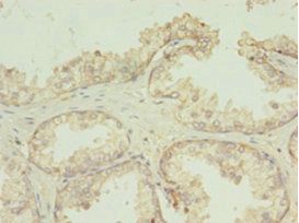 TMEM141 antibody