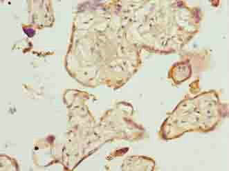 TMEM143 Antibody