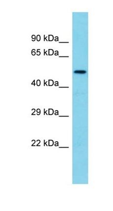 TMEM143 antibody