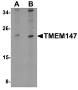 TMEM147 Antibody