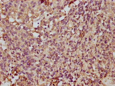 TMEM14A Antibody