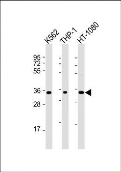 TMEM158 antibody