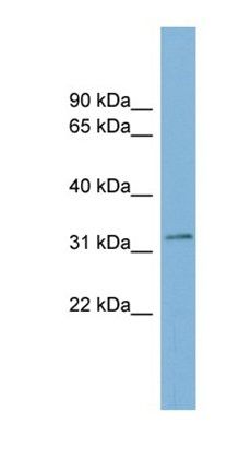 TMEM163 antibody