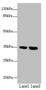 TMEM165 Antibody
