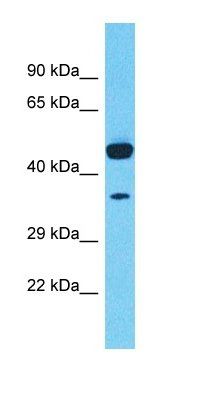 TMEM168 antibody