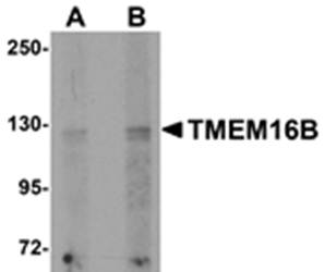 TMEM16B Antibody