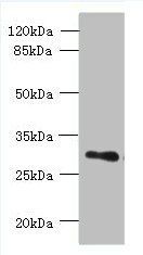 TMEM176B antibody